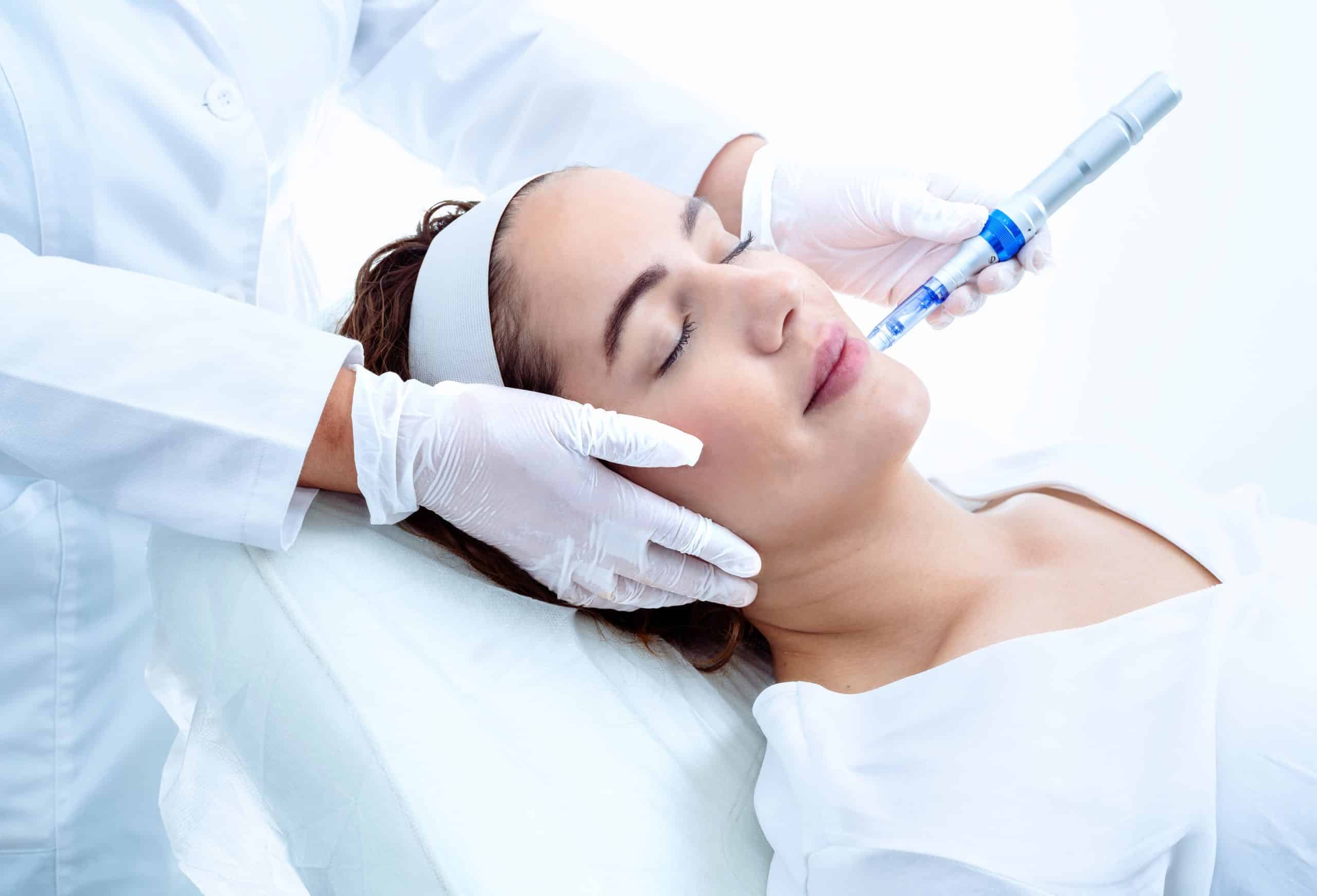 Microneedling Benefits Side Effects Cost Results