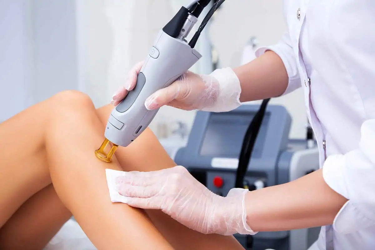 Patient receiving laser hair removal treatment in Tupelo, MS