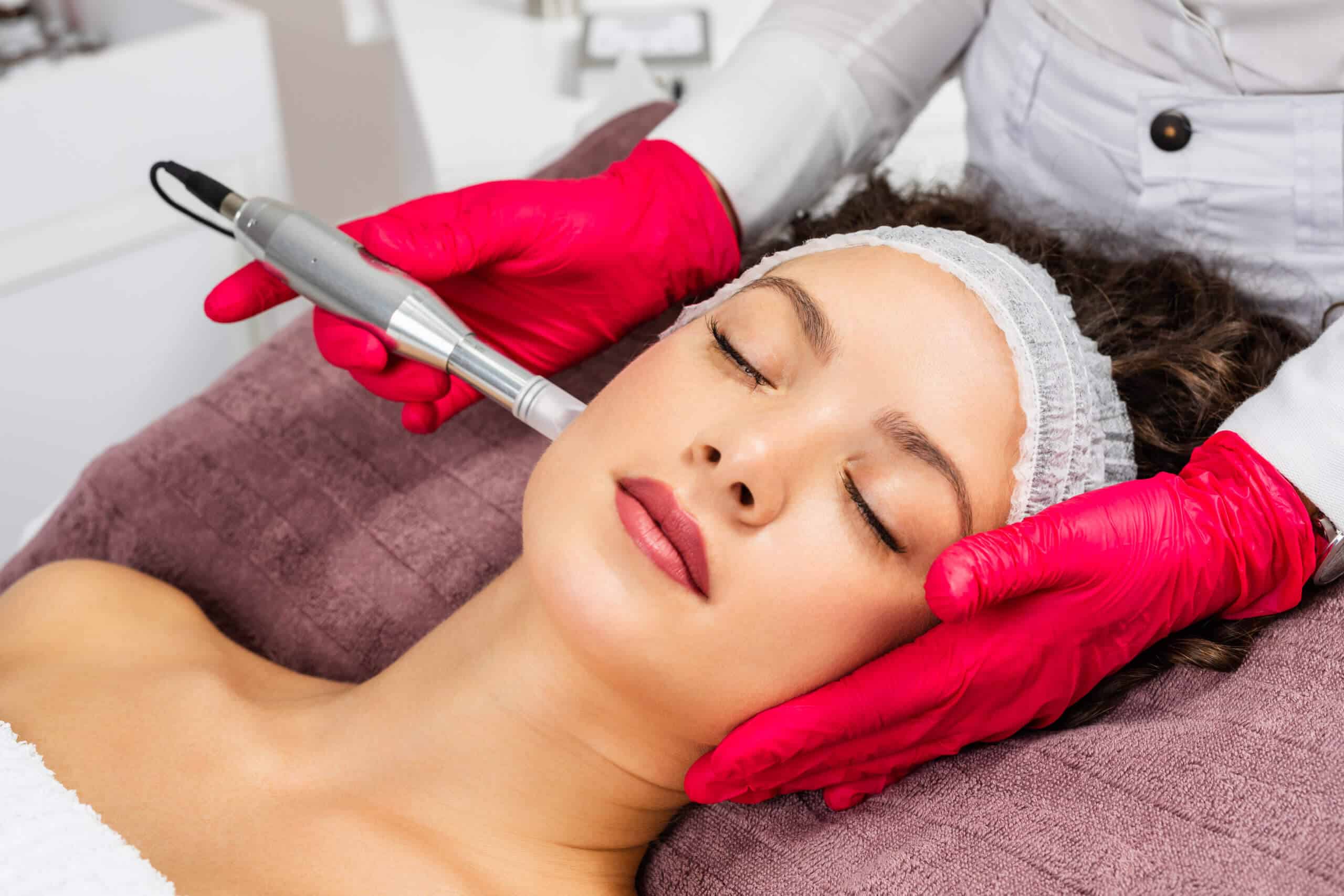 Microneedling rejuvenation treatment, Mesotherapy by Remedy Aesthetics and Wellness in Tupelo, MS